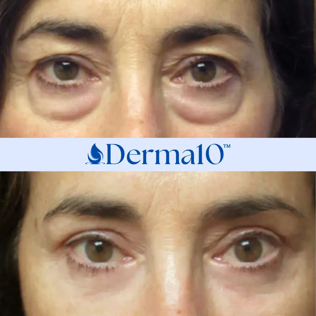 Derma10™ Face Lifting Serum