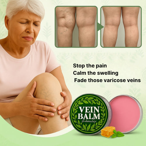 VeinBalm™ – Natural Vein Relief Balm